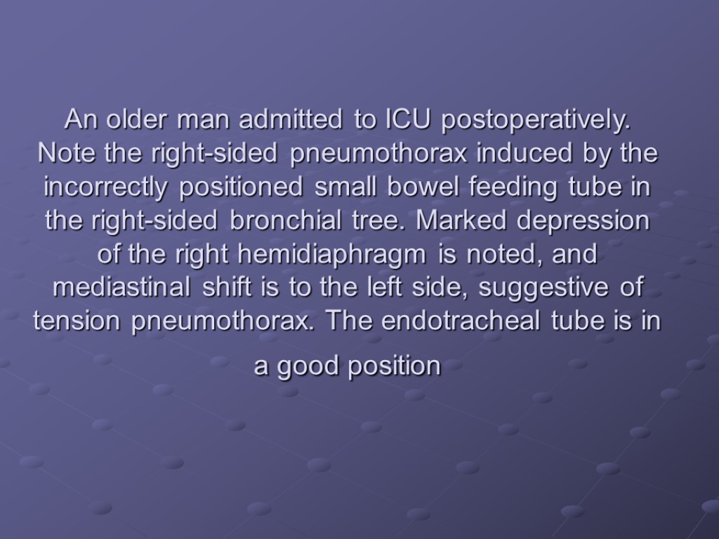 An older man admitted to ICU postoperatively. Note the right-sided pneumothorax induced by the